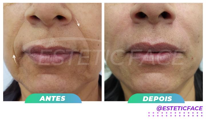bigode-chins---03.jpg