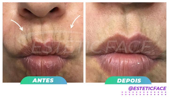 preenchimento-cdigo-de-barras.jpg